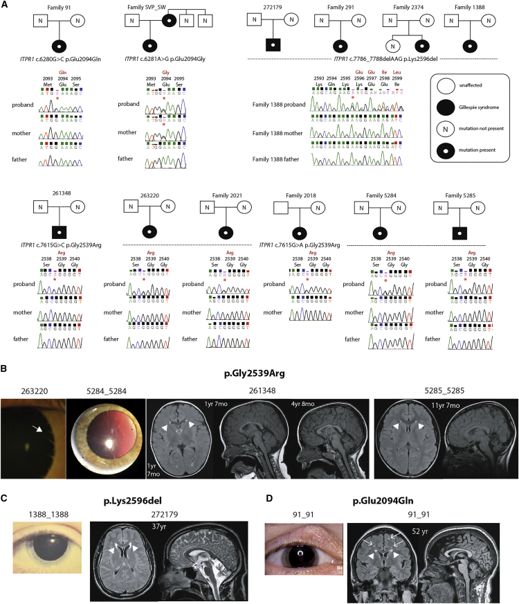 A Restricted Repertoire of De Novo Mutations in ITPR1 Cause Gillespie ...