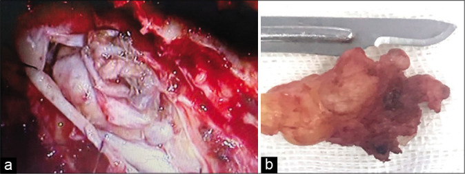 Figure 2: