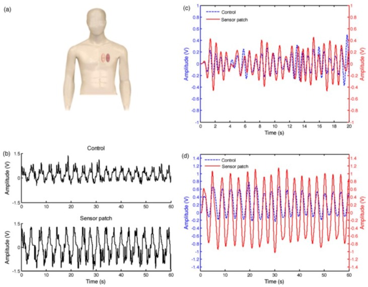 Figure 13