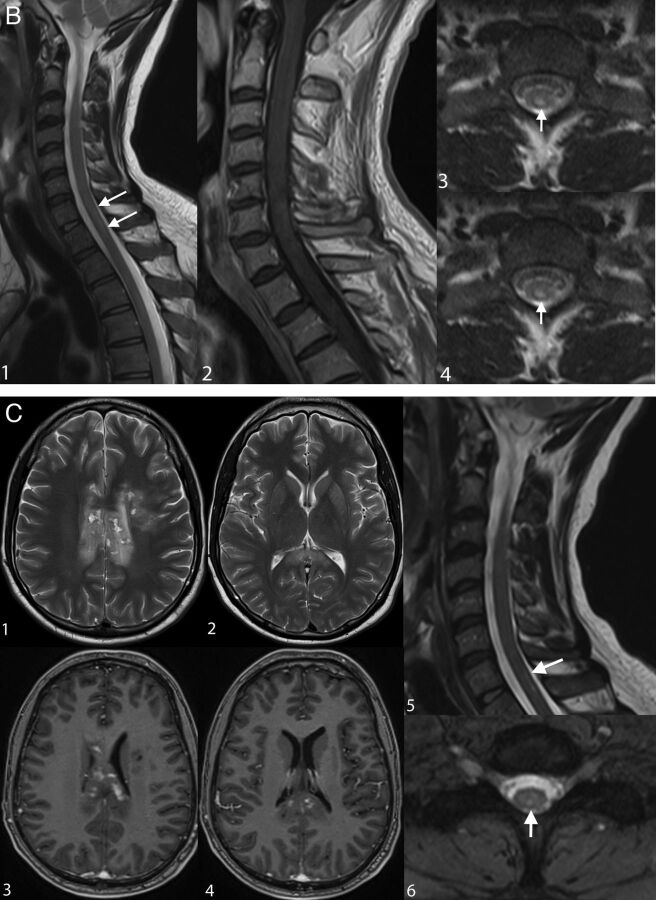 Fig 3.