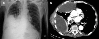 FIG 1