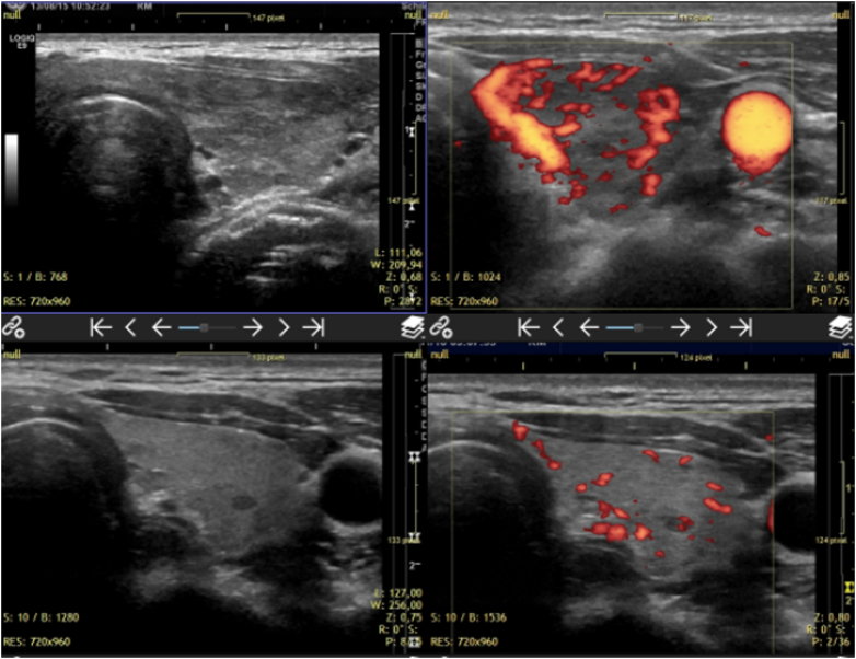 Fig. 4