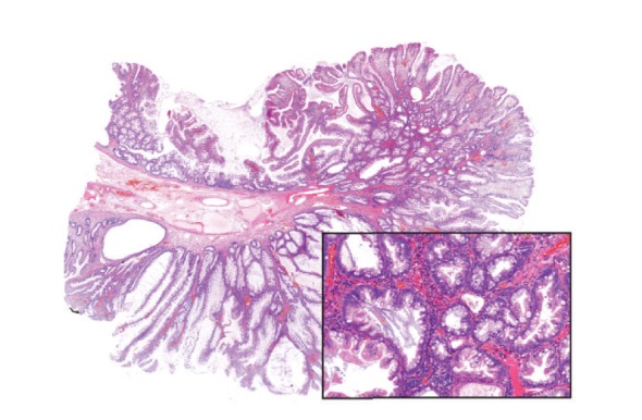 Figure 14