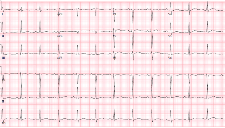 Figure 3