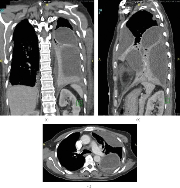 Figure 5