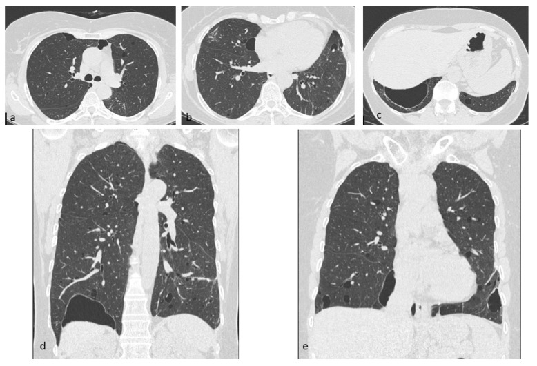 Figure 14