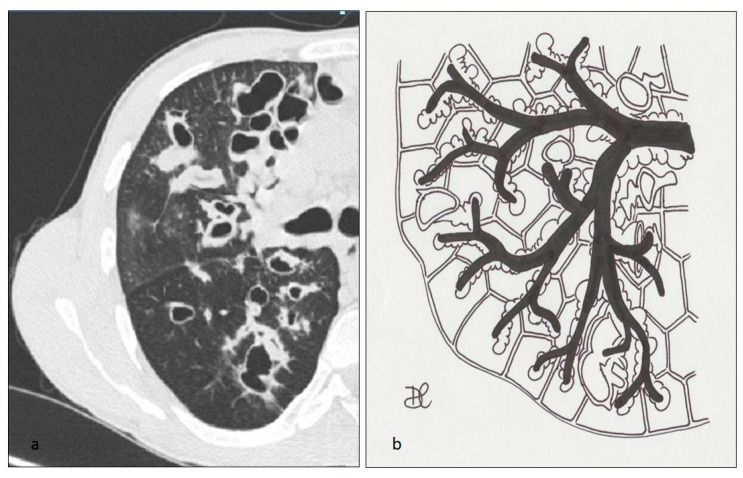 Figure 17