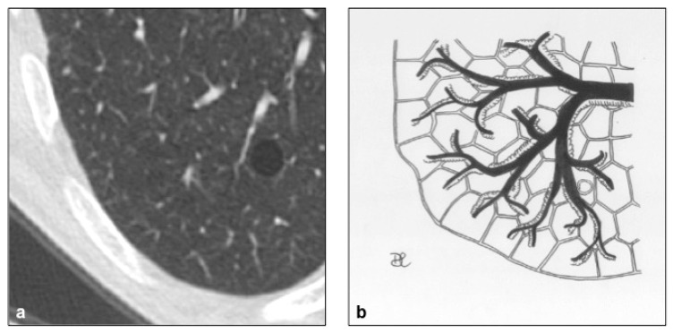 Figure 20