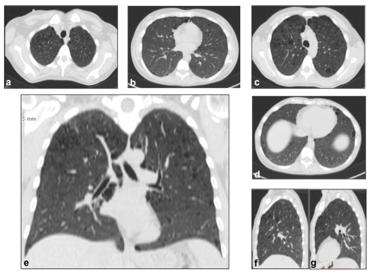 Figure 13