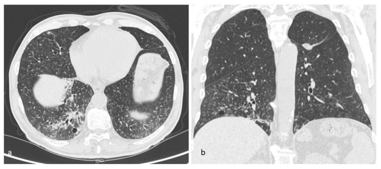 Figure 16