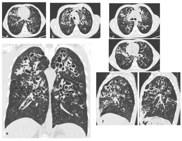 Figure 18