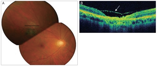 Fig. 3