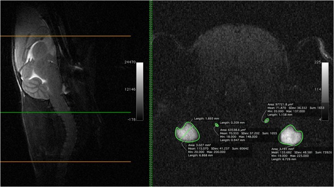 Fig 16