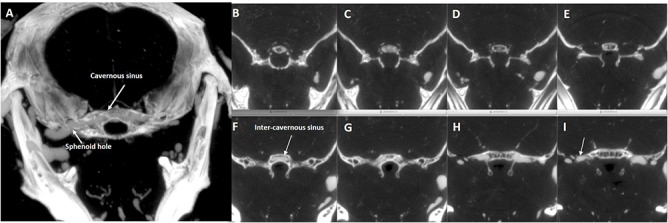 Fig 11