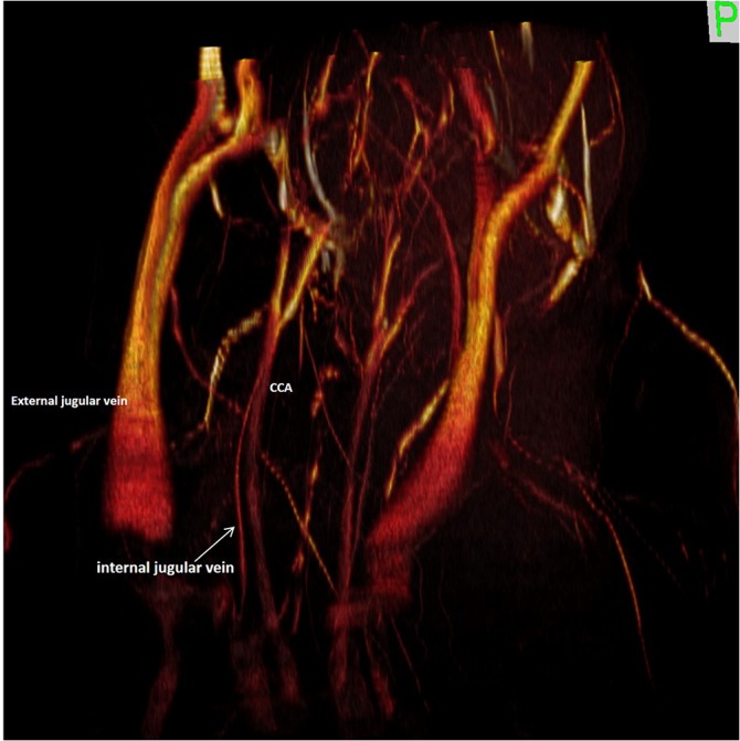 Fig 12