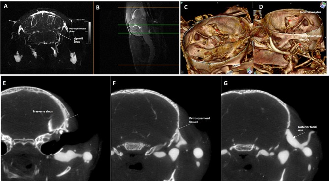 Fig 8