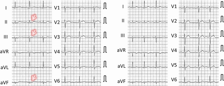 Fig. 2