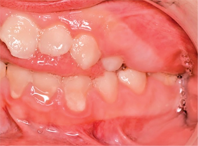 Fig. 10