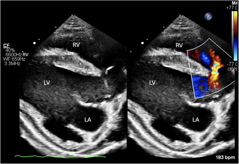 Figure 3