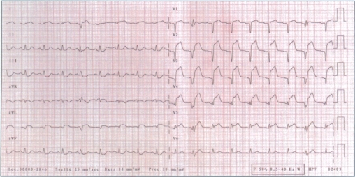 Figure 1B