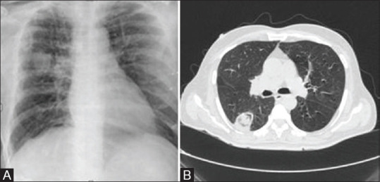 Figure 6 (A and B)