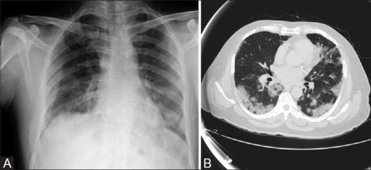 Figure 3 (A and B)