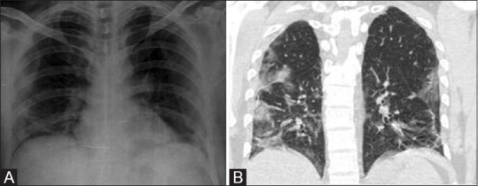 Figure 4 (A and B)