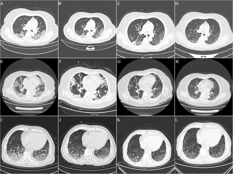 Fig. 2