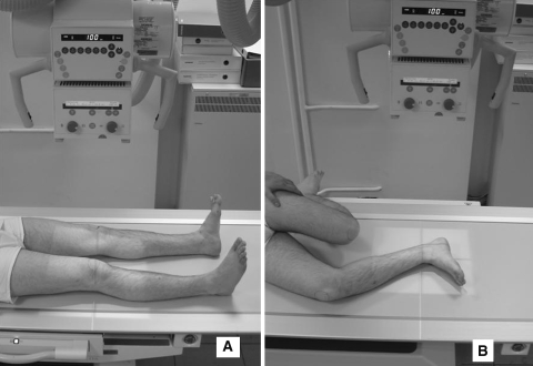 Fig. 2A–B