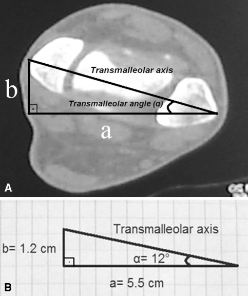 Fig. 4A–B