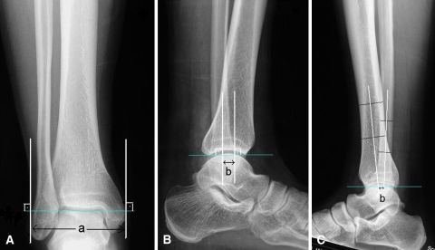 Fig. 3A–C