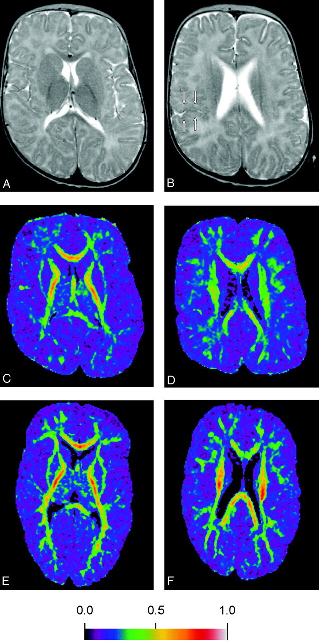 Fig 1.