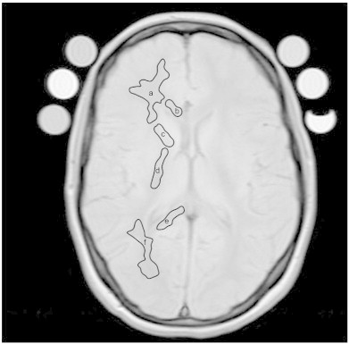 Fig. 1