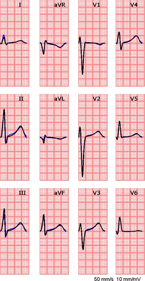 Figure 6