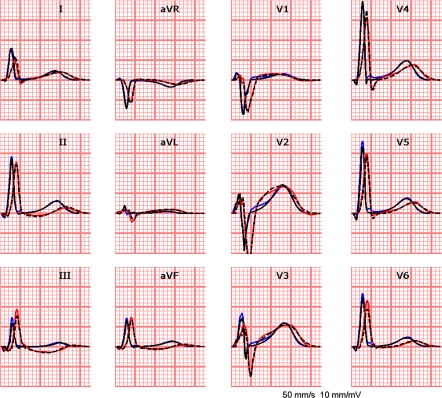 Figure 10