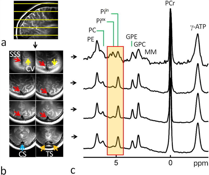 FIG. 3