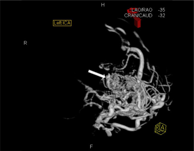 Figure and Video 3