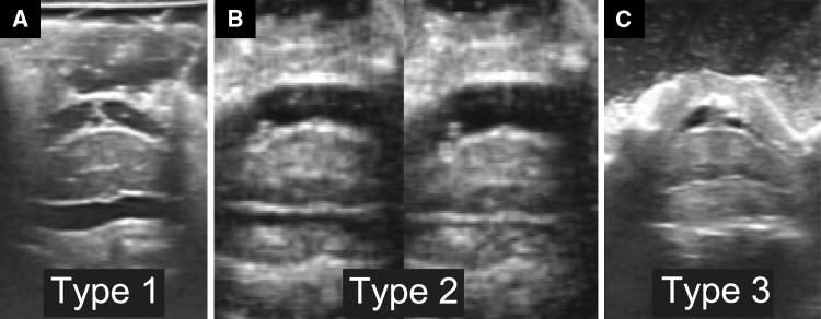 Fig. 1