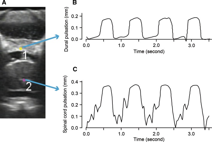 Fig. 2