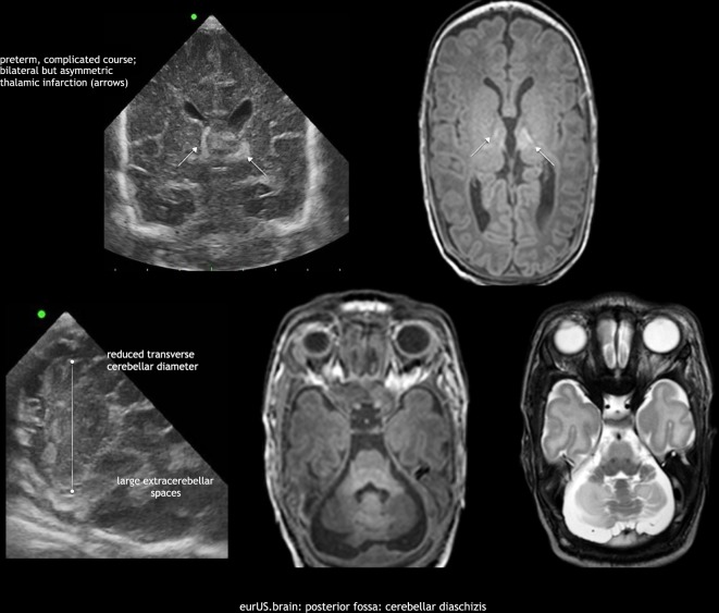 Fig. 11