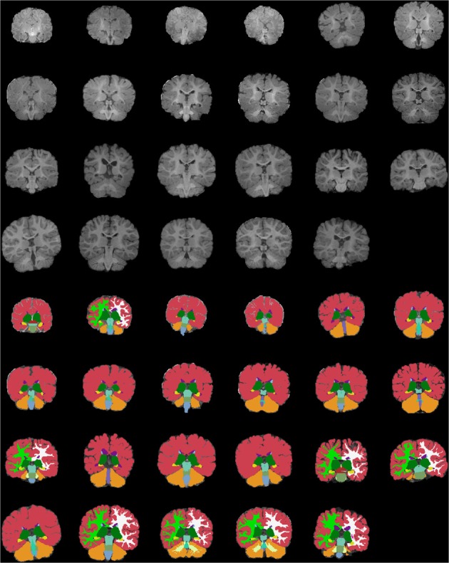 Figure 14