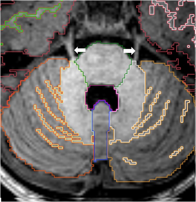 Figure 11