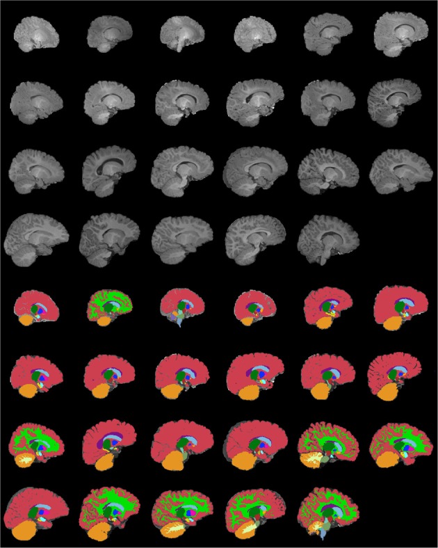 Figure 15