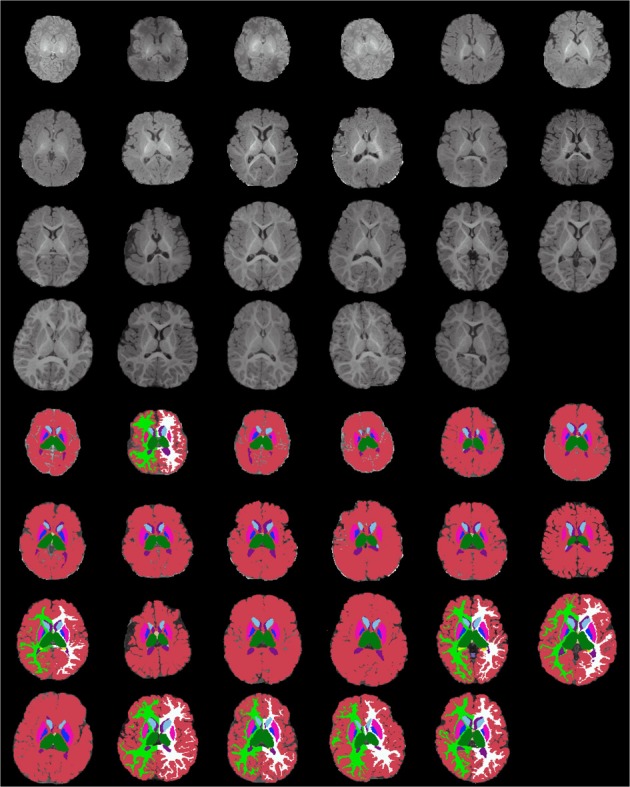 Figure 13