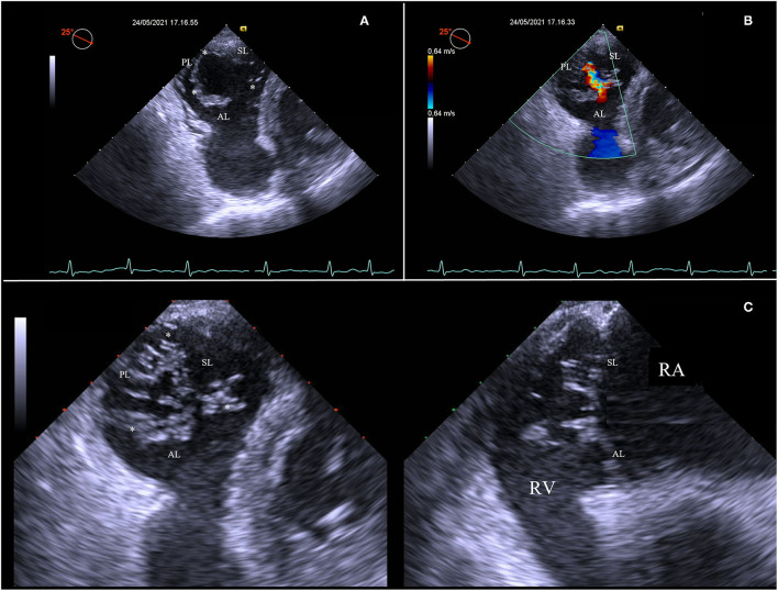 Figure 2