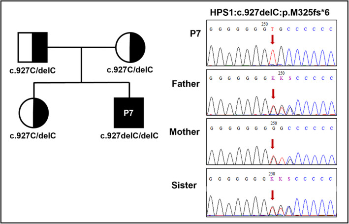 FIGURE 4