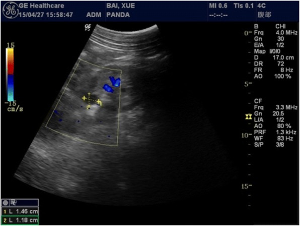 Fig. 2