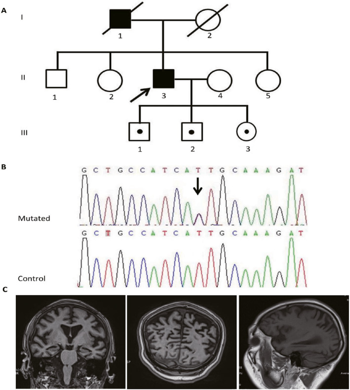 Figure 2