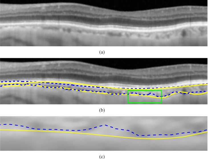 Fig. 11