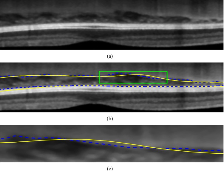 Fig. 12